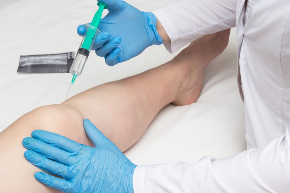 How Hyaluronic Injection Helps in Knee Pain? Dr. Robinson