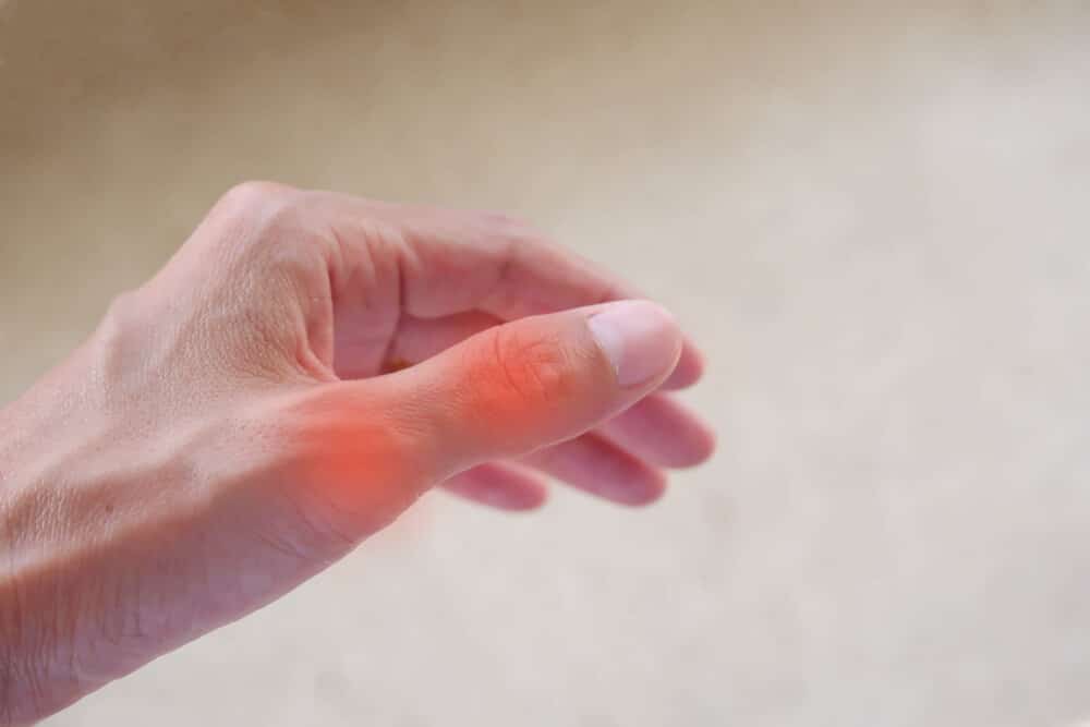 Thumb MCP Joint Pain Symptoms and Treatment by CopperJoint