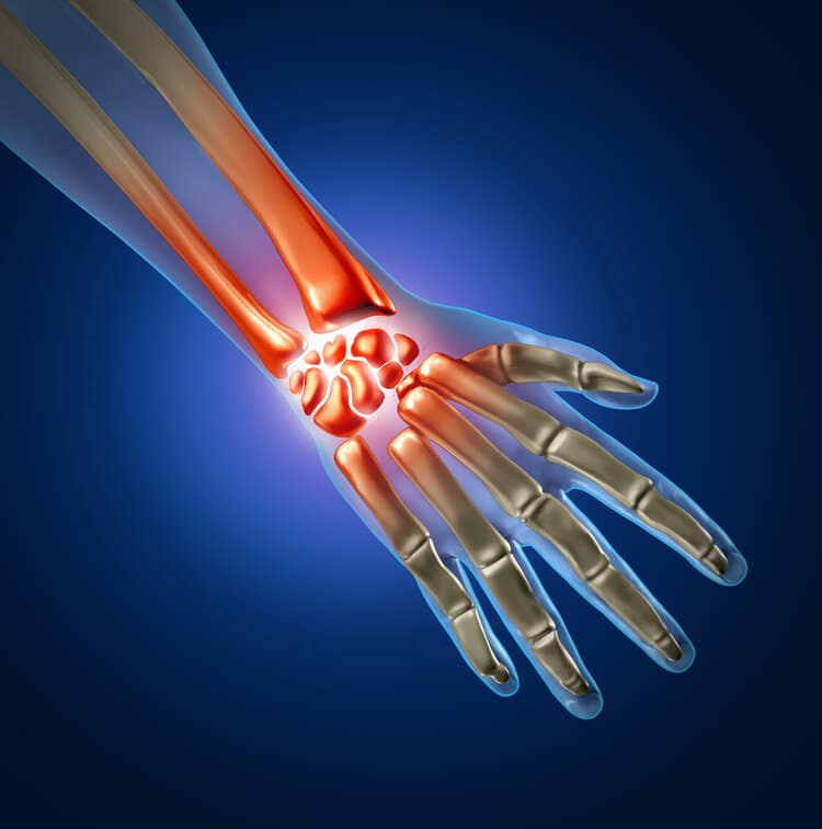 Ulnar Nerve Subluxation, Elbow Surgery Oklahoma City