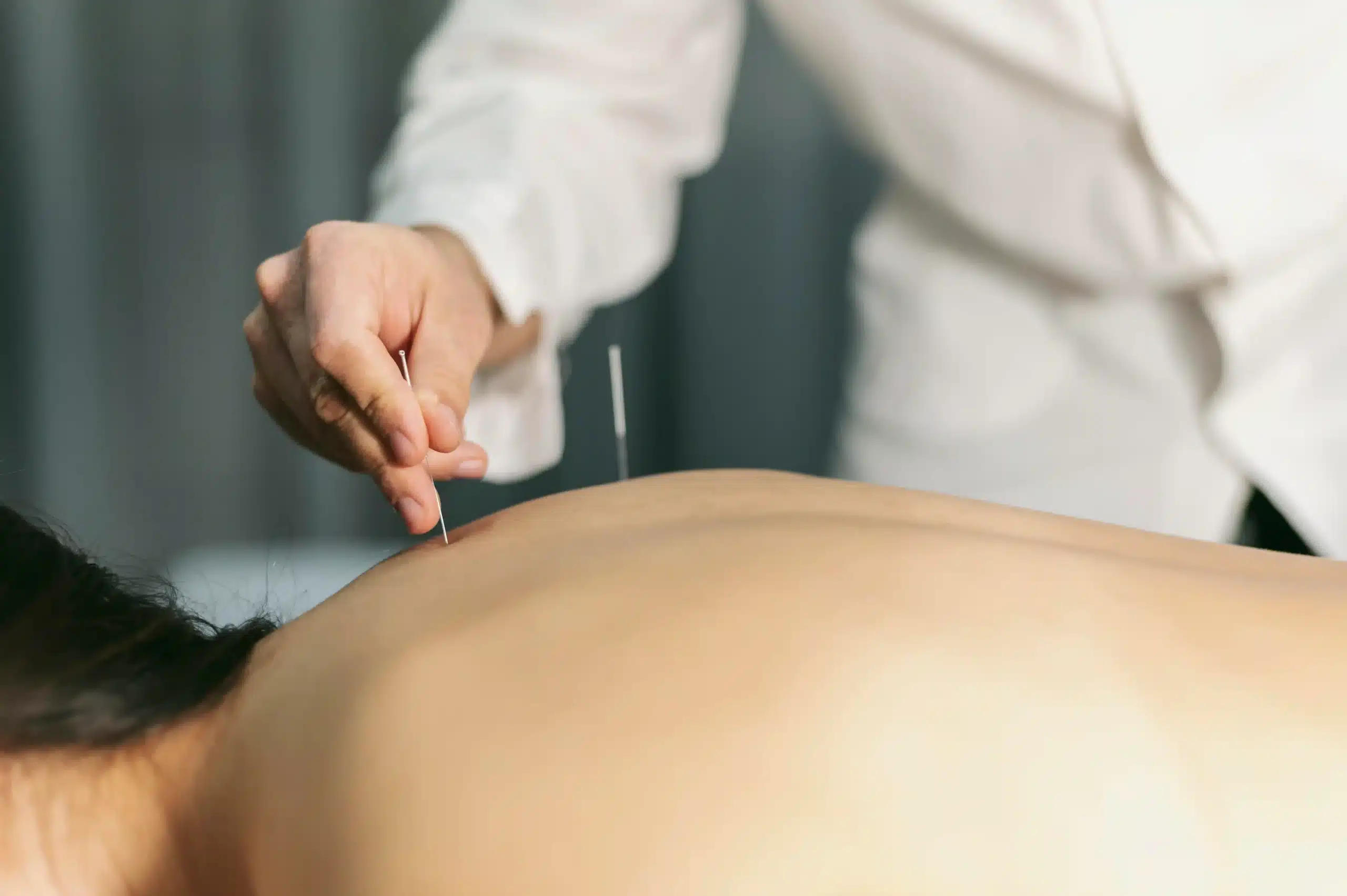 Acupuncture vs. Emsculpt Neo For Back Pain